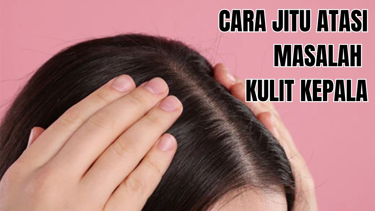 Mengatasi Masalah Kulit Kepala Secara Alami